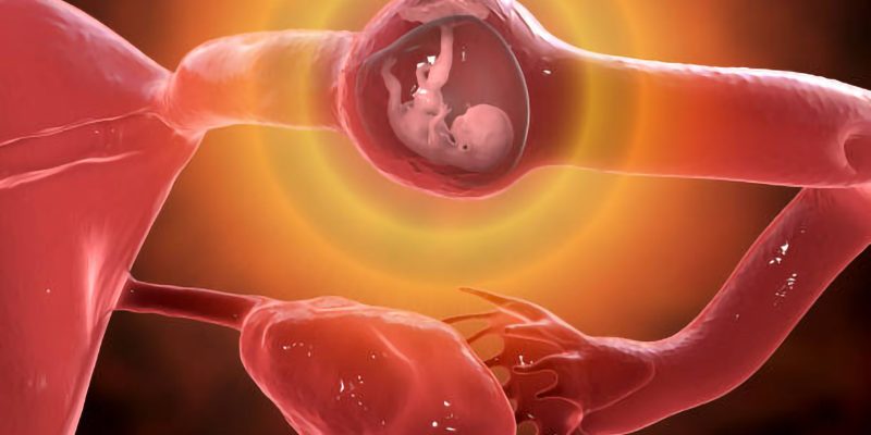 Tubal ectopic pregnancy, 3D illustration showing an 8-week human fetus implanted in the fallopian tube instead of uterus